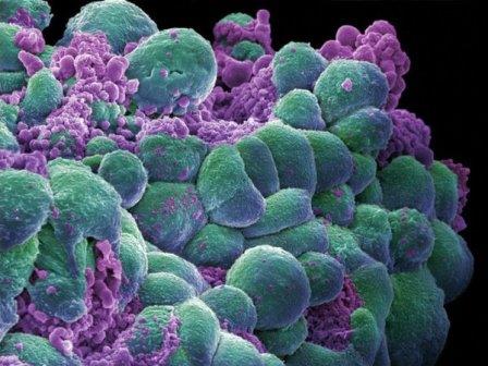 Ученые разобрались, что происходит в клеточных ядрах при развитии рака